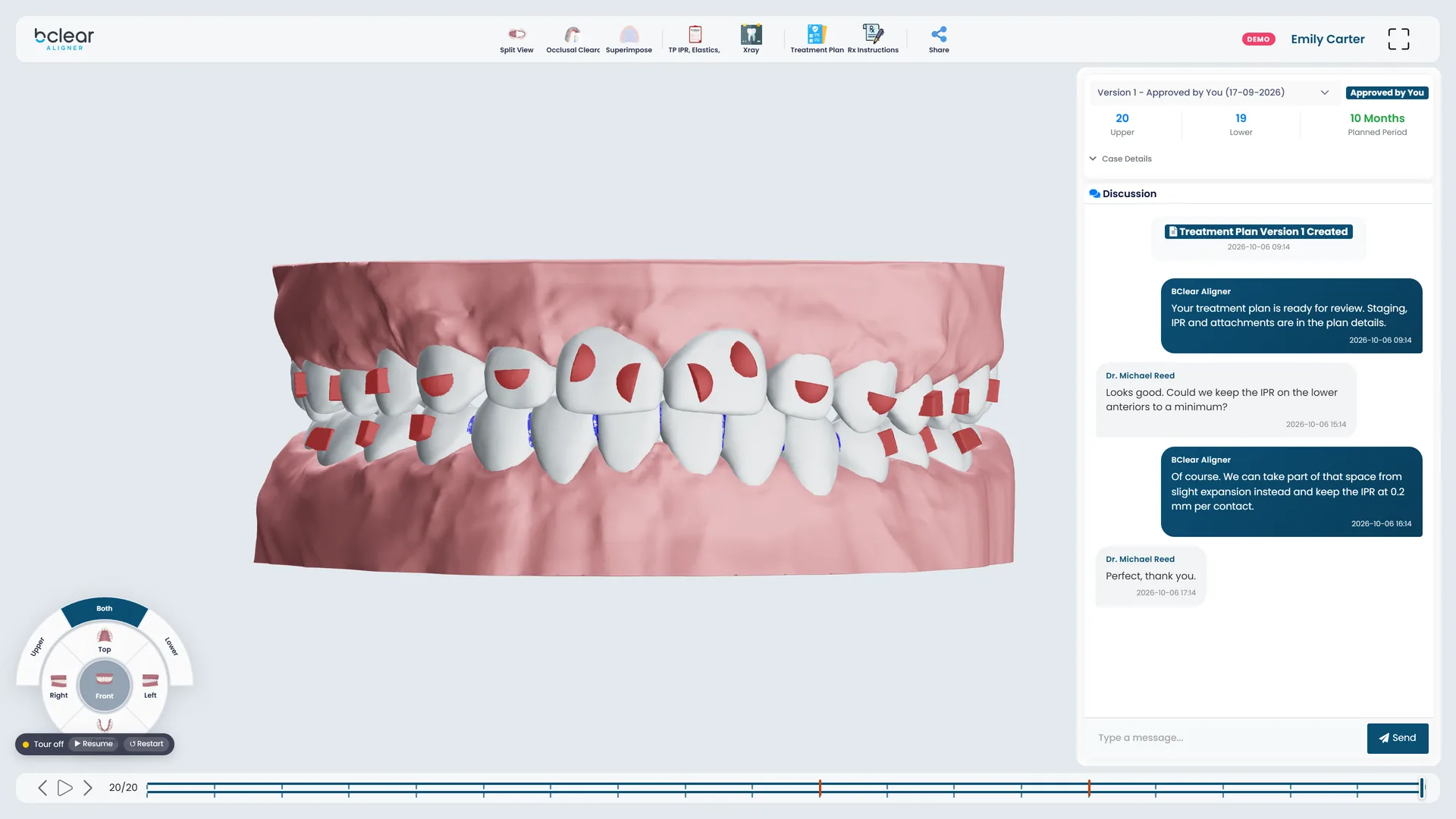 PlanStudio showing a sample case at its final stage: both arches with attachments, the stage timeline, plan details and the discussion with the planner.