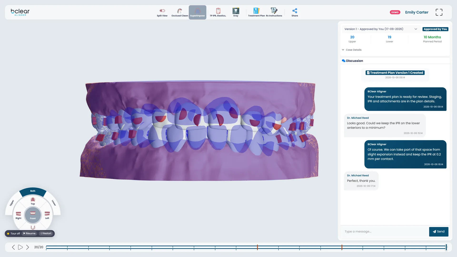 PlanStudio superimposition of the first and final stages.